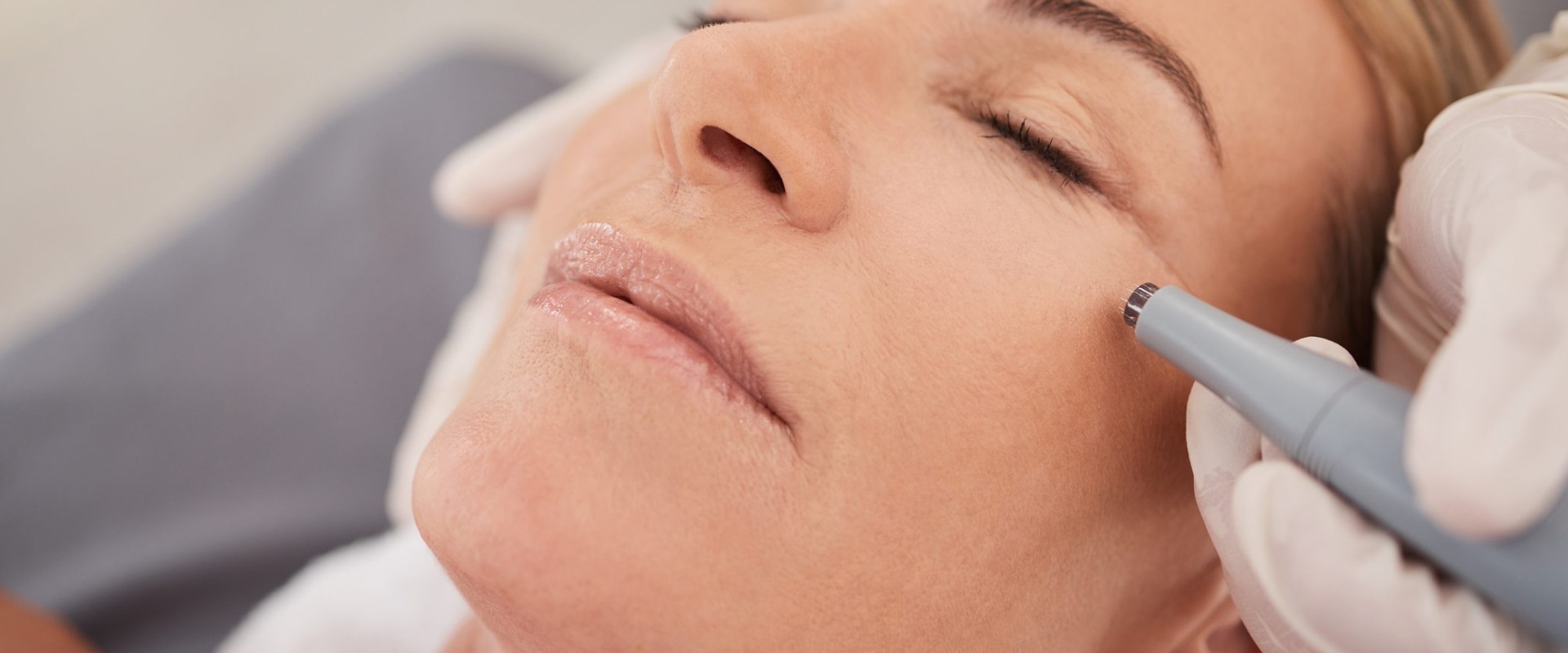Wrinkle Reduction Treatments: A Comprehensive Overview