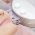 The Benefits of Facial Rejuvenation at Medical Spas