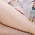 Everything you Need to Know About Hair Removal Treatments