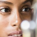 Acne Treatments Procedures