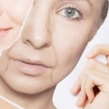 Everything You Need to Know About Anti-Aging Treatments