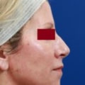 Medical Spa Reviews by Aestheticians