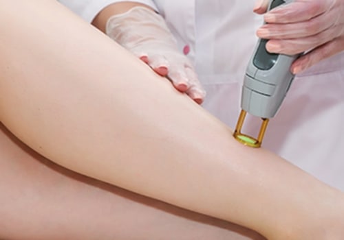 Everything you Need to Know About Hair Removal Treatments