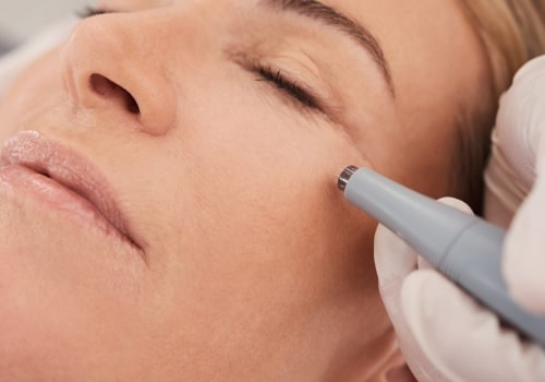 Wrinkle Reduction Treatments: A Comprehensive Overview